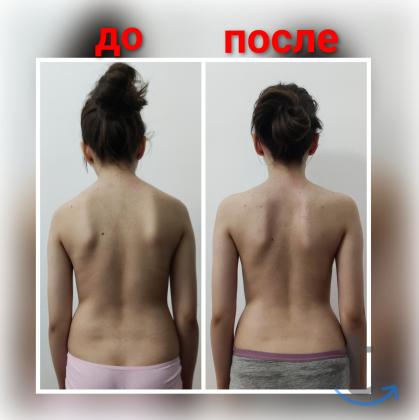 Массаж, Лечебный массаж в Грозном