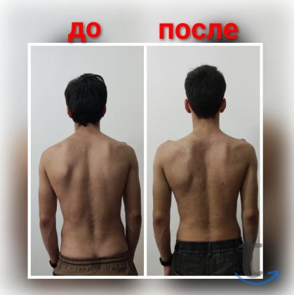 Массаж, Лечебный массаж в Грозном