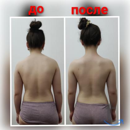 Массаж, Лечебный массаж в Грозном