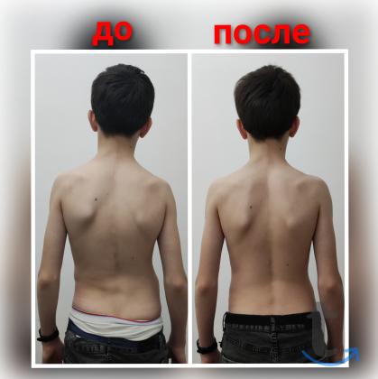 Массаж, Лечебный массаж в Грозном