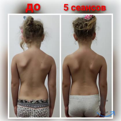 Массаж, Лечебный массаж в Грозном