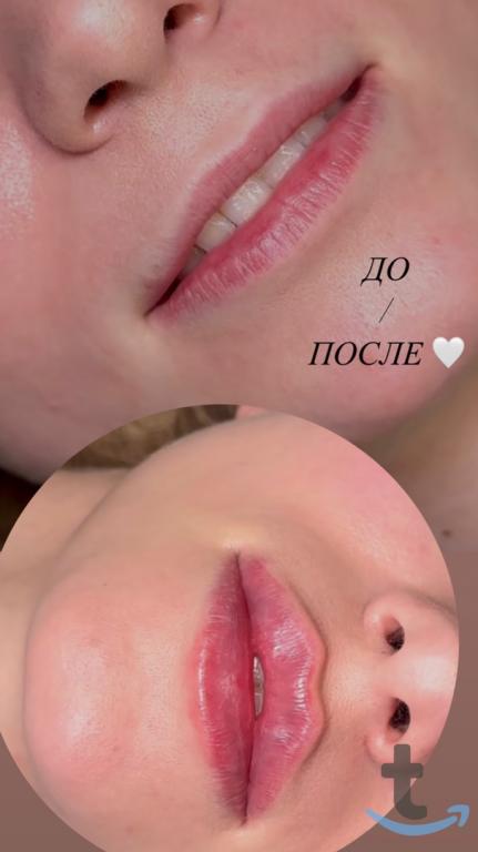 Услуги косметолога Воронеж в Воронеже